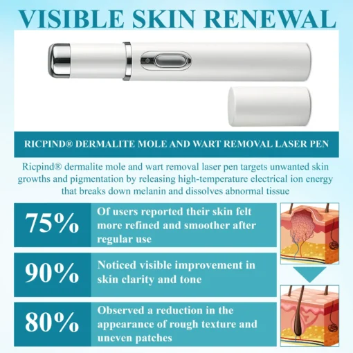 RICPIND® DermaLite Mole and Wart Removal Laser Pen
