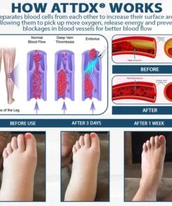 RICPIND® VenoLight Edema Relief TENS Pen
